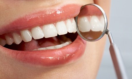 Für 2 Personen: Kosmetisches Zahnbleaching