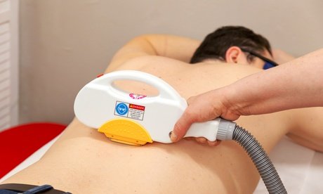Große Zone für Damen: 3x IPL/SHR-Laser-Haarentfernung