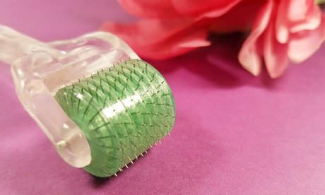 2x 60 Min. kosmetisches Microneedling für 1 Perso