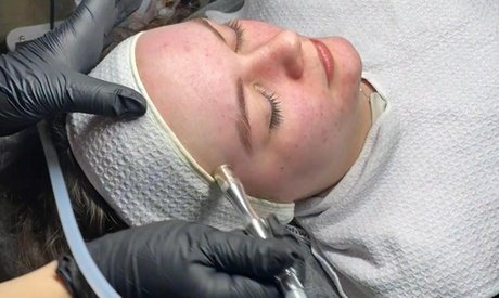 Luxus-Paket: 60 Min Bio-Microneedling inkl. 15 Min. verwöhnende GuaSha-Gesichtsmassage für 1 Person