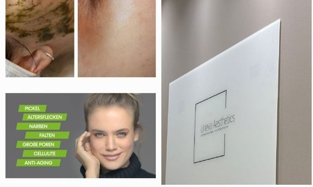 60-minutige Gesichtsbehandlung Double Peel inkl. Hals und Dekolleté