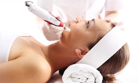 1x Microneedling mit Hyaluron