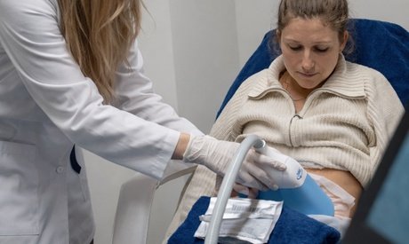 3x Kryolipolyse-Behandlung an einer Zone nach Wahl