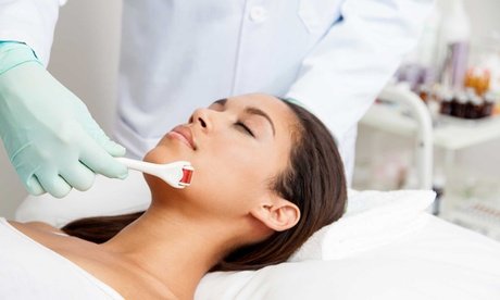 60 Min. kosmetisches Microneedling