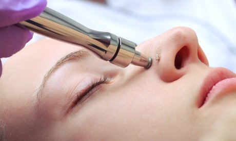 Diamant Mikrodermabrasion