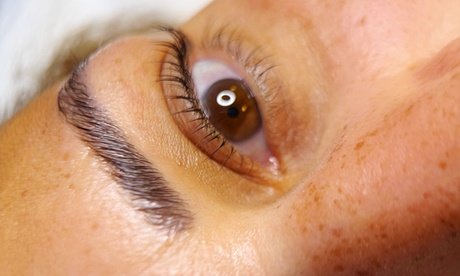 3x Microneedling inkl. Lichttherapie für 1 Person