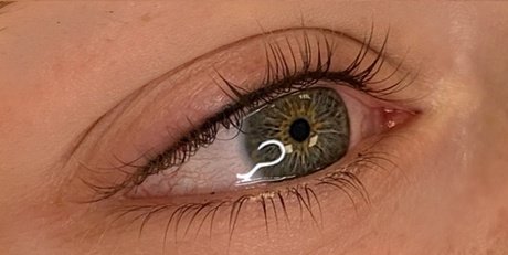 Mit Nachbehandlung nach 4 Wochen: Wimpernkranzverdichtung / schmaler Lidstrich