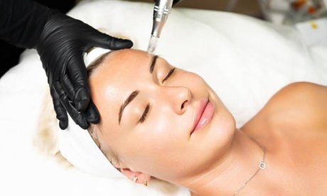 1x ca. 60 Min. Microneedling inkl. Ampulle