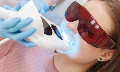 1 Kosmetisches Zahn-Bleaching inkl. Beratung