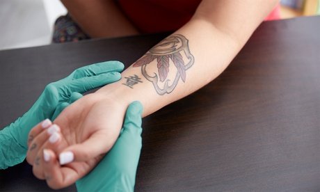 Entfernung von Permanent Make-up und Tattoos mit Enzymen