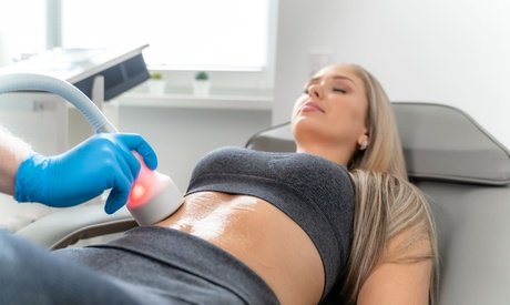 1x 50 Min. CryoShaper-Anwendung an 2 Zonen nach Wahl