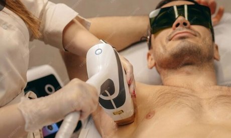 Thumbnail - 1 Behandlung an 1 kleinen Zone nach Wahl: Diodenlaser-Haarentfernung