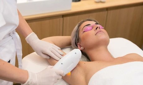 3x Kleine Zone nach Wahl: Ice Diodenlaser-Haarentfernung