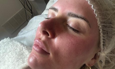 60 Min. klassische Gesichtsreinigung für 1 Person