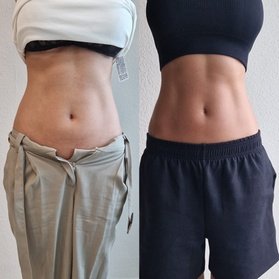 1x 30 Min . EMS-Training mit ausführlichem Beratungsgespräch