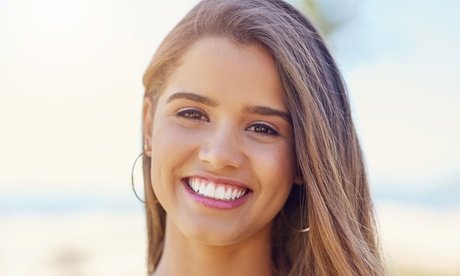 90 Minuten kosmetisches Zahnbleaching inkl. kosmetischer Zahnreinigung