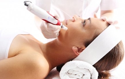 1x 80 Min. Mesolift mit Diamant-Mikrodermabrasion für 1 Person