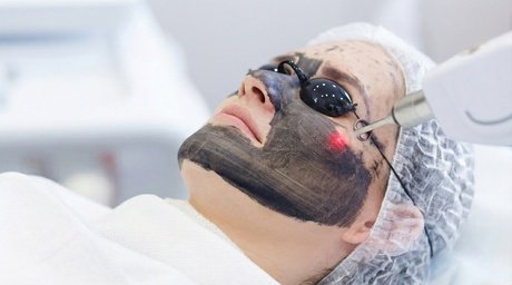 BB-Glow-Behandlung mit Hyaluron & Microneedling mit Willkommensgetränk für 1 Person