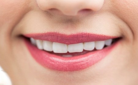 2 Kosmetische Zahnbleachings à 30 Min. für 1 Person