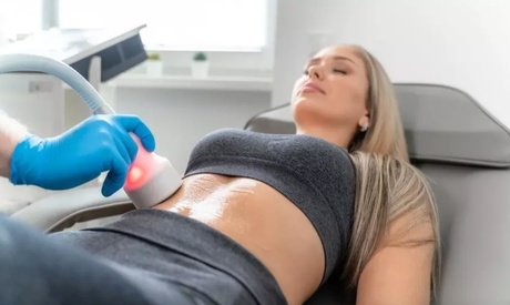 30 Min. für 1 Zone an Bauch nach Wahl: Anwendung mit dem CryoShaper