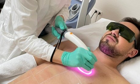 Eine INTIM Dioden Laser-Haarentfernungs-Sitzung für Frauen Vakuum-Technologie