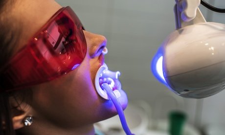 1x 50 Min. Kosmetisches Zahn-Bleaching