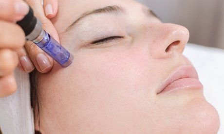 1x 60 Min. Microneedling für das Gesicht inkl. Wirkstoffampulle