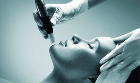 3mal Microneedling- ein Kur