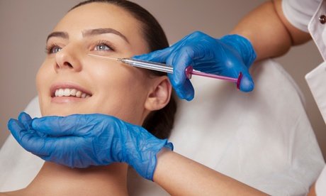 Inkl. 2 Microneedling-Behandlungen: 5-Punkte-Facelifting mit 1 ml Hyaluronsäure