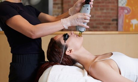 6x Haarentfernung mittels Diodenlaser an 1 kleinen Zone nach Wahl