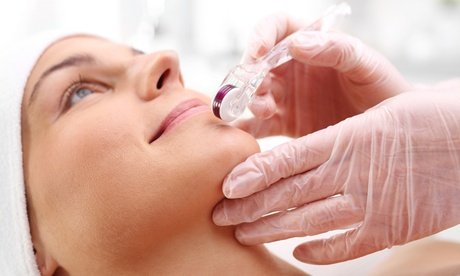 Microneedling Gesichtsbehandlung Anti-Age