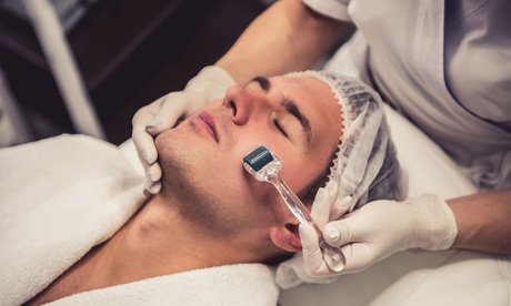 1x Microneedling-Behandlung an einer Zone nach Wahl für 1 Person