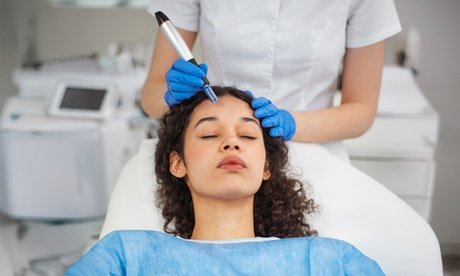 1 Microneedling-Behandlung à 50 Min. für das Gesicht für 1 Person