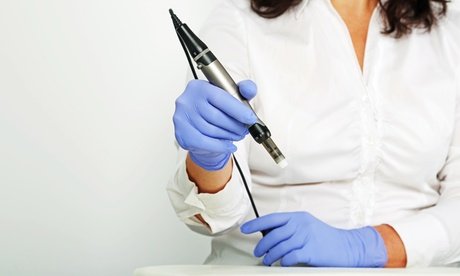 60 Min. Kosmetisches Microneedling mit Hyaluron und Kollagenseren