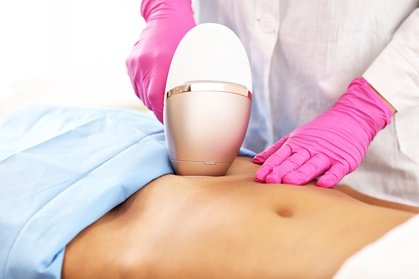 1 x Ganzkörper Haarentfernung mit 4 Wellen ICE Diodenlaser für DAMEN ( ohne Gesicht )