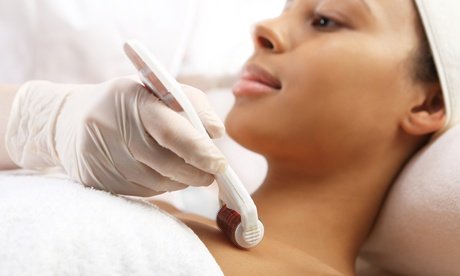 Microneedling +BB Glow