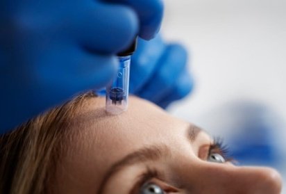 60 Min. Microneedling-Anti-Aging-Behandlung für das Gesicht inkl. Hyaluron