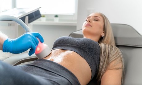 1x 50 min CryoShaper Anwendung für 2 Zonen