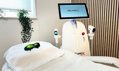 1x Laserhaarentfernung an 1 kleinen Zone nach Wahl