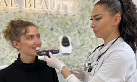 60 Min. Zahn-Bleaching-Paket