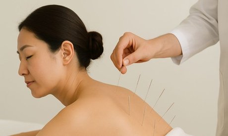 2 Sitzungen mit bis zu 45 Min. Koreanische Akupunktur inkl. Anamnese für 1 Person