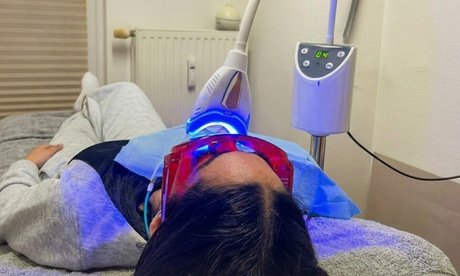 Kosmetisches Zahnbleaching: 1 Durchgang á 15 Min. für 1 Person