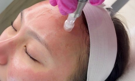 Premium Gesichtsreinigung: Tiefenreinigung Dampfreinigung Hydration