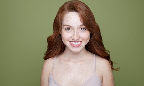 Fadenlifting mit 10 Fäden für 1 oder 2 Zonen nach Wahl