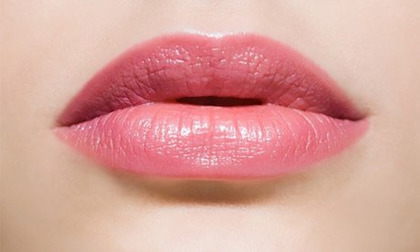 Lippenaufbau von Ober- und Unterlippe mit bis zu 0 5 ml Hyaluron