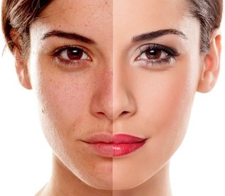 45-60 Min. Gesicht: BB-Glow-Behandlung