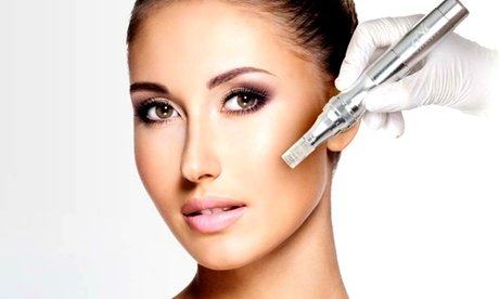 60 Min. Microneedling-Gesichtsbehandlung