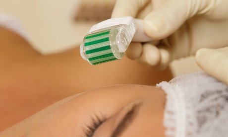 Wertgutschein über 149 € anrechenbar auf 1x 60 Min. Bio-Microneedling