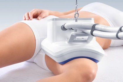 Eine lokalisierte Probe Kryotherapie-Sitzung inkl. Beratung