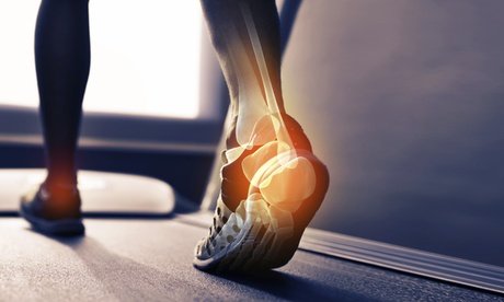 Sensomotorische Analyse bis zur Hüfte inkl. Auswertung und Übungen